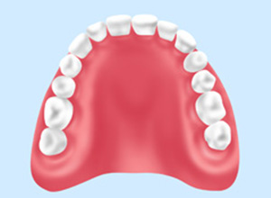 入れ歯治療の場合
