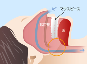 正常な睡眠時の状態