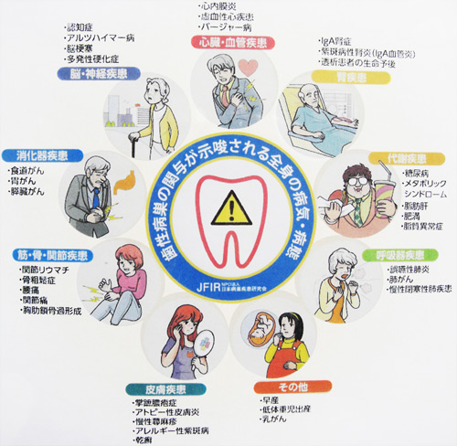 「病巣感染」をご存知ですか？