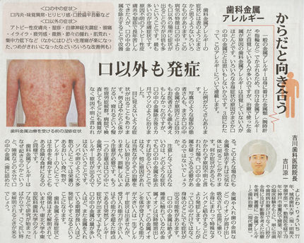 2009年（平成21年）11月10日（火）　毎日新聞掲載