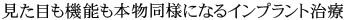 見た目も機能も本物同様になるインプラント治療