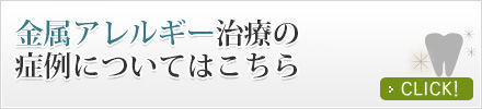 金属アレルギー治療の症例についてはこちら