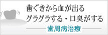 歯ぐきから血が出るグラグラする・口臭がする 歯周病治療